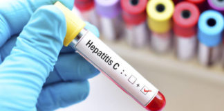 mexicanos infectados hepatitis C diagnosticados
