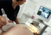 Trump limitará visas a mujeres embarazadas para frenar el "turismo de maternidad"